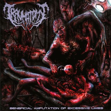 Traumatomy : Beneficial Amputation Excess Limbs